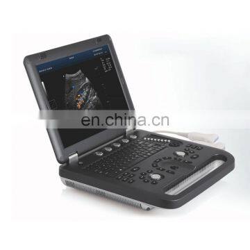 MY-A024F medical machines laptop ultrasound color doppler full digital portable ultrasound for sale