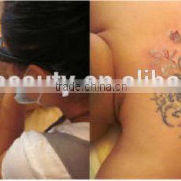 Professional 4 in 1 Ipl Shr Laser System Hair and Tattoo Removal Machine for Sale photo-5