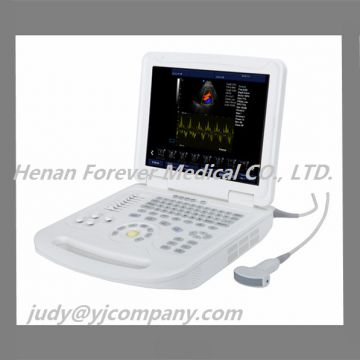 3D / 4D Digital Ultrasound Machine /scanner Color Doppler