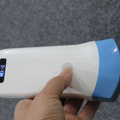 5C Convex Palm B/W Ultrasound photo-5