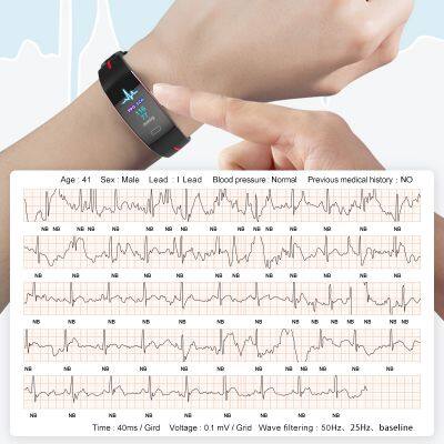 Monitoring Watch Intelligent Health Electrocardiogram and Blood Pressure Monitoring photo-5