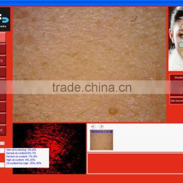 Professional Clinic Use Face Skin Analysis Equipment With FCC/CE Approval photo-2