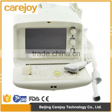 18 months Warranty China manufacturer usb ultrasound scanner with factory price