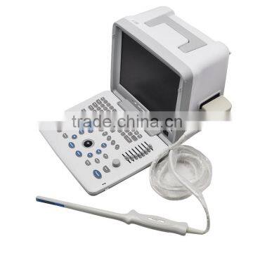 Carejoy Ultrasound Machine Portable Ultrasound Scanner With Multi Frequency Probe for Hospital Clinics Community With CE ISO photo-5