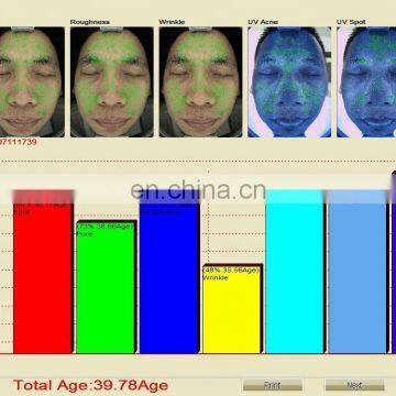 Multi Function Light Facial Skin Analysis Machine for Skin Sensitiveness And Age Test