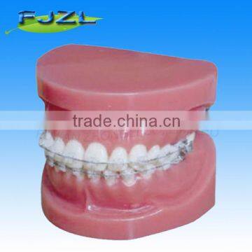 orthodontic teeth model(normal model),dental orthodontic models