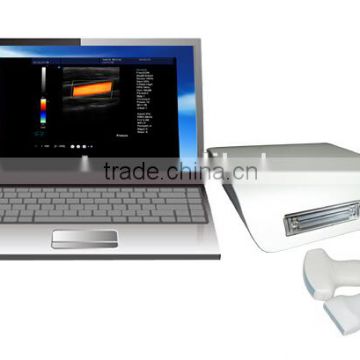 CBox-5 Color Doppler Ultrasound Box