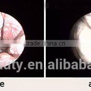 1ms-5000ms Private Health Beautify Vagina CO2 Fractional Laser Vaginal Tightening Machine 0.1-2.6mm photo-6