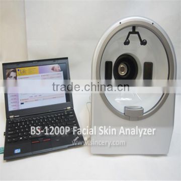 3D Skin Analyzer 12 Mega Pixel Visia Dermatology magic mirror skin analyzer