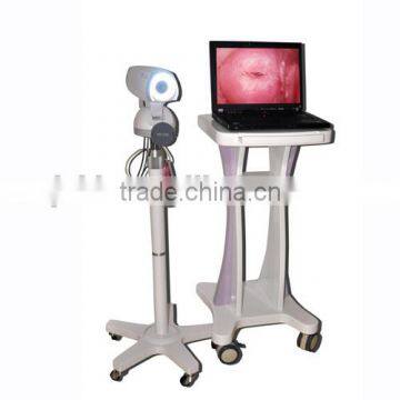 CE & ISO Approved Electronic Digital Video Colposcope on Sale photo-2