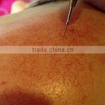 30 MHZ Spider Vein Vascular Removal Device/high Frequency Vascular Removal Device photo-6