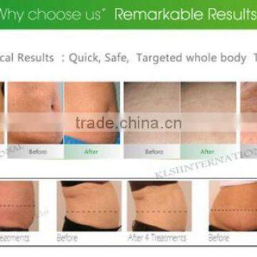 Ultrasonic Cavitation Body Sculpting High Quality Vacuum Cavitation Body Slimming Machine System Slimming Machines 1MHz photo-4