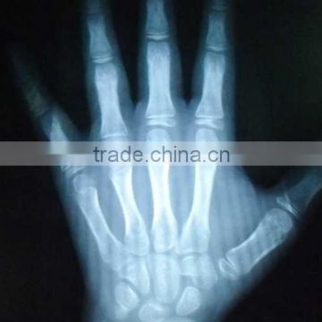 Industrial film digitizer, film manufactures to chinese,medical dry film for x-ray equipment