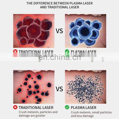 Non-invasive Painless Ozone Plasma Pen Laser Skintag Remove Machine 2 IN 1 Spot Acne Scar Wrinkle Removal Beauty Instrument photo-3
