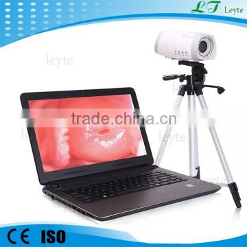 LTY9800 portable digital video colposcope