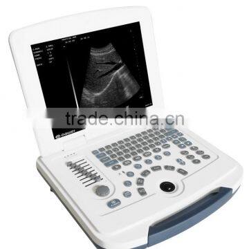 laptop PC Notebook digital diagnostic ultrasound scanner WT580