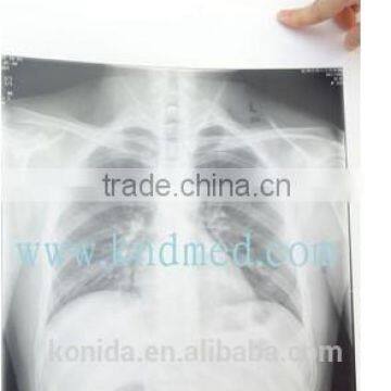 Agfa X-ray Film 14x17 Blue Medical Film 8x10in Made in Chinafilm for Hospital Agfa X-ray Film photo-5
