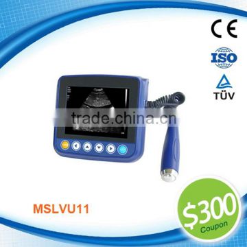 Coupon available! MSLVU11 Palmtop diagnostic ultrasound scanner for animals