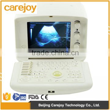 Different kinds of medical machine Multi-frequency cheap price ultrasound scanner