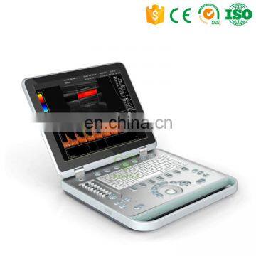 MY-A024 new design portable echocardiography Notebook Color doppler ultrasound diagnostic scanner