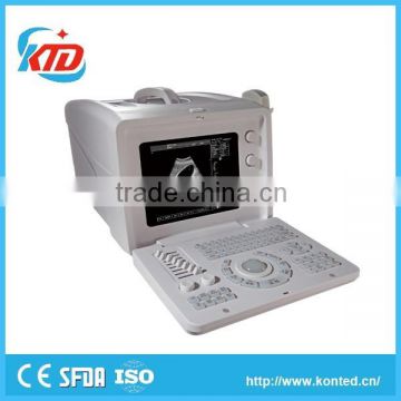 SA801P Classic Ultrasound Medical Device with CRT display