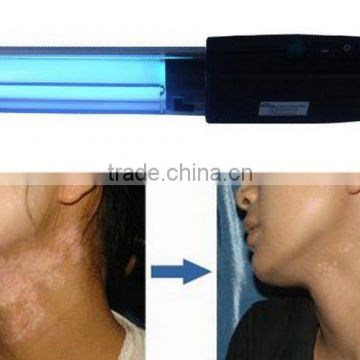 home use 311 nm UVB Lamps for vitiligo/psoriasis/eczema treatment