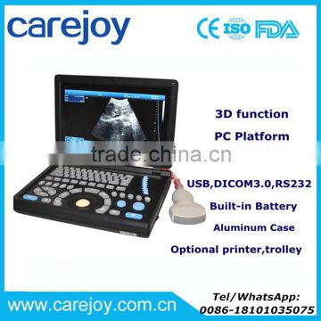 Big Sale PC platform 10.4 inch Laptop Ultrasound Scanner with 3.5Mhz Convex probe CE ISO certified