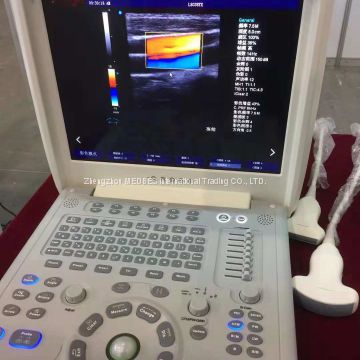 Portable Color Ultrasound Scanner