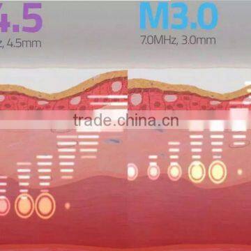 2016 Beauty Salon Device Vaginal Rejuvenation Hifu Vaginal Tighten Equipment photo-4