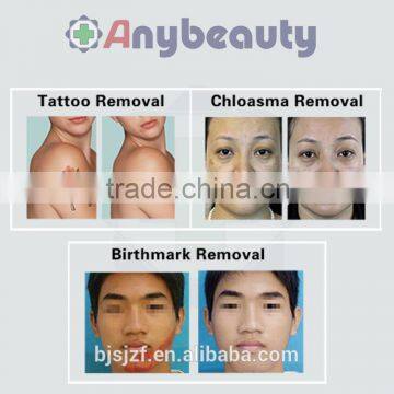 2016 Newest Design High Power Picosecond Tattoo Laser / Tattoo Removal Picosure Lasers