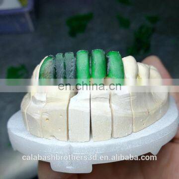 High Accuracy 0.01MM Chinese DLP Dental 3D Printer Sale photo-6