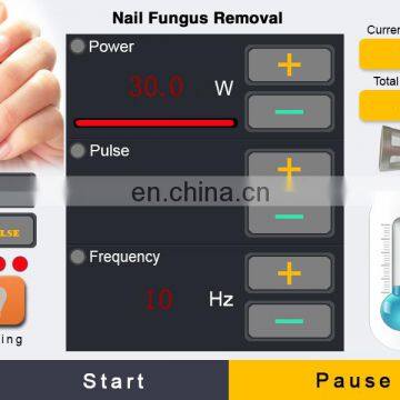China Lasertell Best Popular 0.01mm Needle Design Treatment Pen Getting Rid of Spider Veins