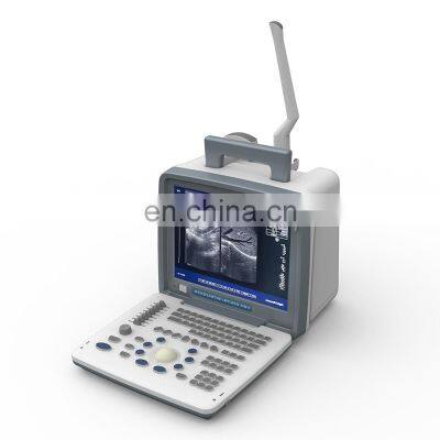 Good discount  Full digital LED portable ultrasound for medical examination