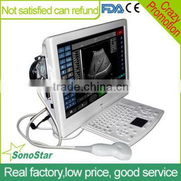 Sonostar 18" high resolution touch screen portable color doppler machine low price UTouch-8