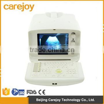 Cheap price Digital Portable Ultrasound Machine/Scanner with convex/linear/transvaginal probe