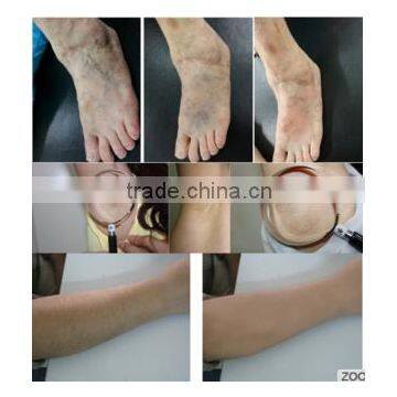 1064nm Mulfunction Beauty Machine:1064nm Long Pulsed ND Yag Laser For Hair Removal And Vascular Removal 800mj