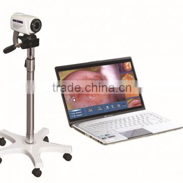 ce approved colposcope with laptop