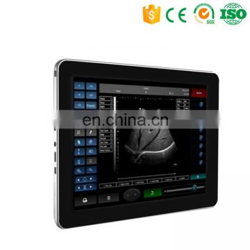 MY-A011 promotion product!compact and portable touch screen diagnostic system ipad ultrasound scanner