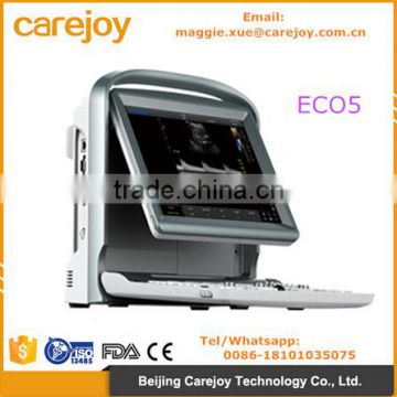 Cheap price Portable/laptop 3D/4D Color Doppler Ultrasound System by CE ISO approved