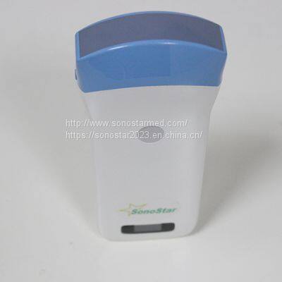 5C Convex Palm B/W Ultrasound photo-2