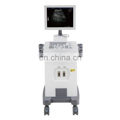 Portable Medical Ultrasound Instruments 15 Inch B/W Full- Digital 2D Ultrasound Trolley Ultrasound Scanner Machine photo-5