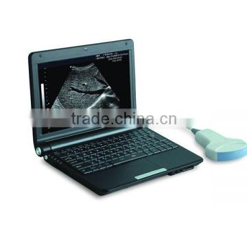 FM-3000D Hot Sale Laptop Ultrasound Scanner for Ultrasonic diagnostic