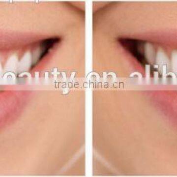 AYJ-J003A Laser Teeth Whitening Machine /teeth Whitening Laser photo-6