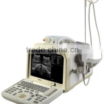 Digital Ultrasound scanner