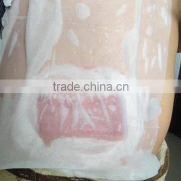 Beco Antifreeze Pad photo-6