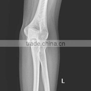 China KND-A/F CE medical dry film radiografia de pie izquierdo