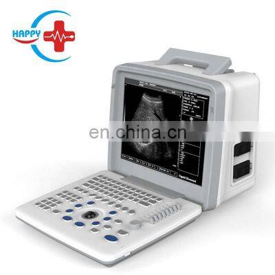 HC-A002 China original cheap LED Full Digital Portable Ultrasound Scanner