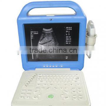 AJ-6100B LCD Portable Pseudo Color US ultrasound scanner machine