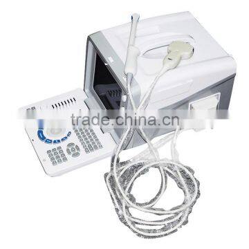 CE Approved Full Digital LCD Display Diagnostic Laptop Ultrasound Scanner photo-5
