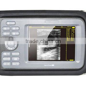 HandScan H8 Portable Handheld Palm Human B/W B Ultrasound Machine With Various Probe-Shelly photo-2